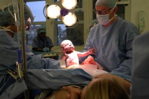 Roger delivering a baby by "natural" caesarean. 